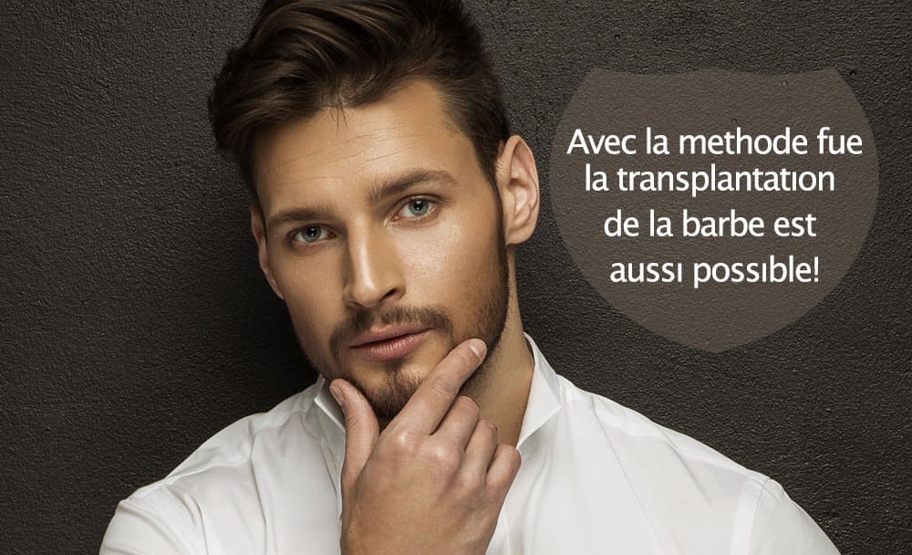 Illustration sur la greffe de barbe FUE