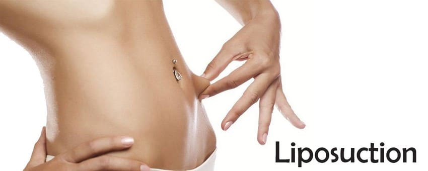 Une femme touche son ventre après une liposuccion