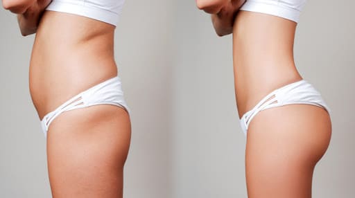 Simulation photo avant et après