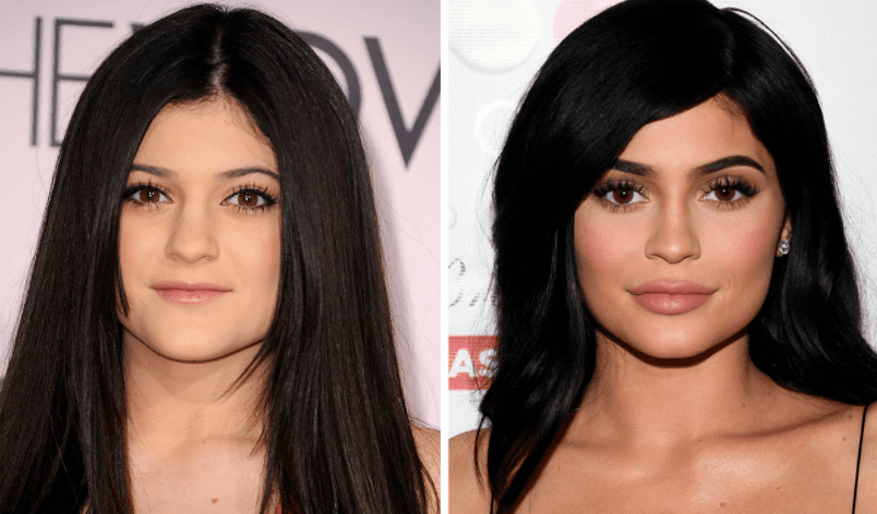 Kylie Jenner après un Fox Eyes