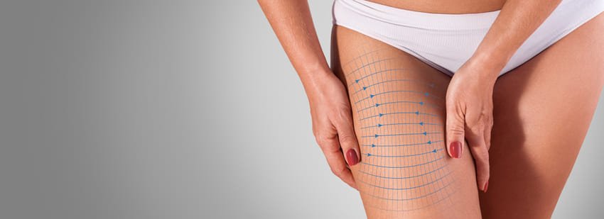 Améliorer l'apparence esthétique des cuisses