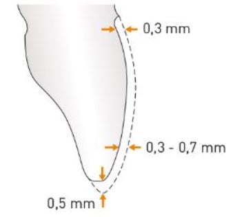 Schéma d'une dent limée